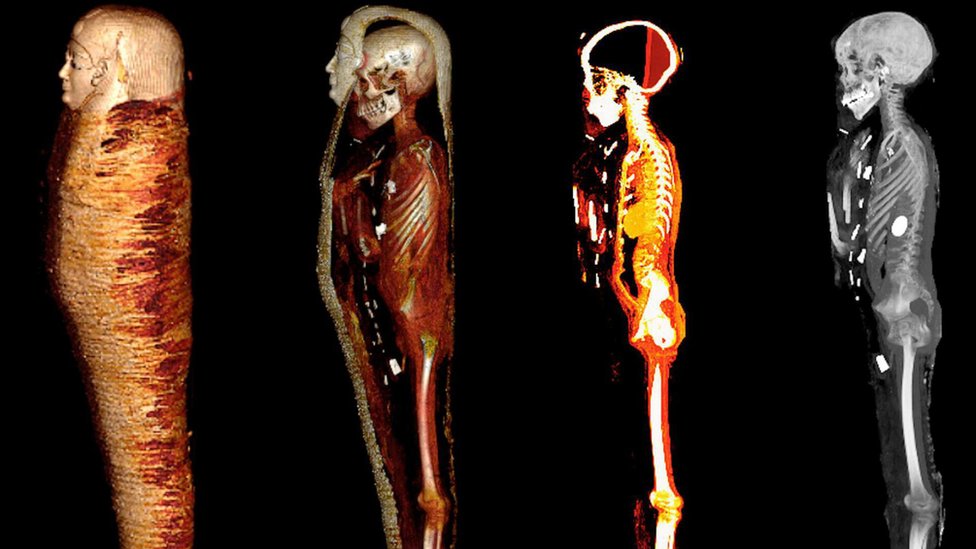 La momia de un adolescente que fue enterrado con un “corazón de oro” hace 2.300 años en Egipto
