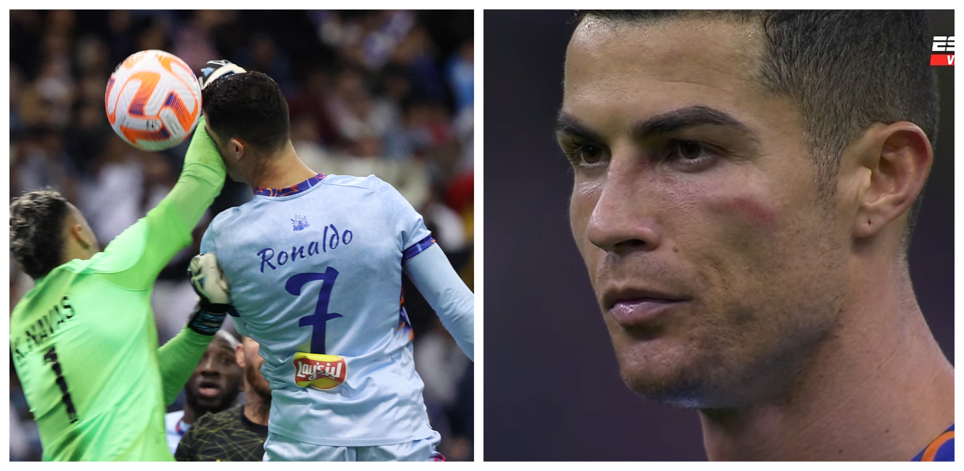 Keylor Navas golpeó en la cara a Cristiano Ronaldo. (Foto Prensa Libre: AFP y captura)