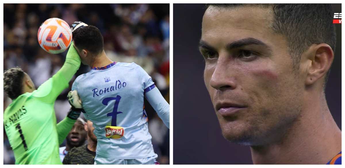 VIDEO | Así fue el brutal golpe de Keylor Navas a Cristiano Ronaldo (Riyadh – PSG)
