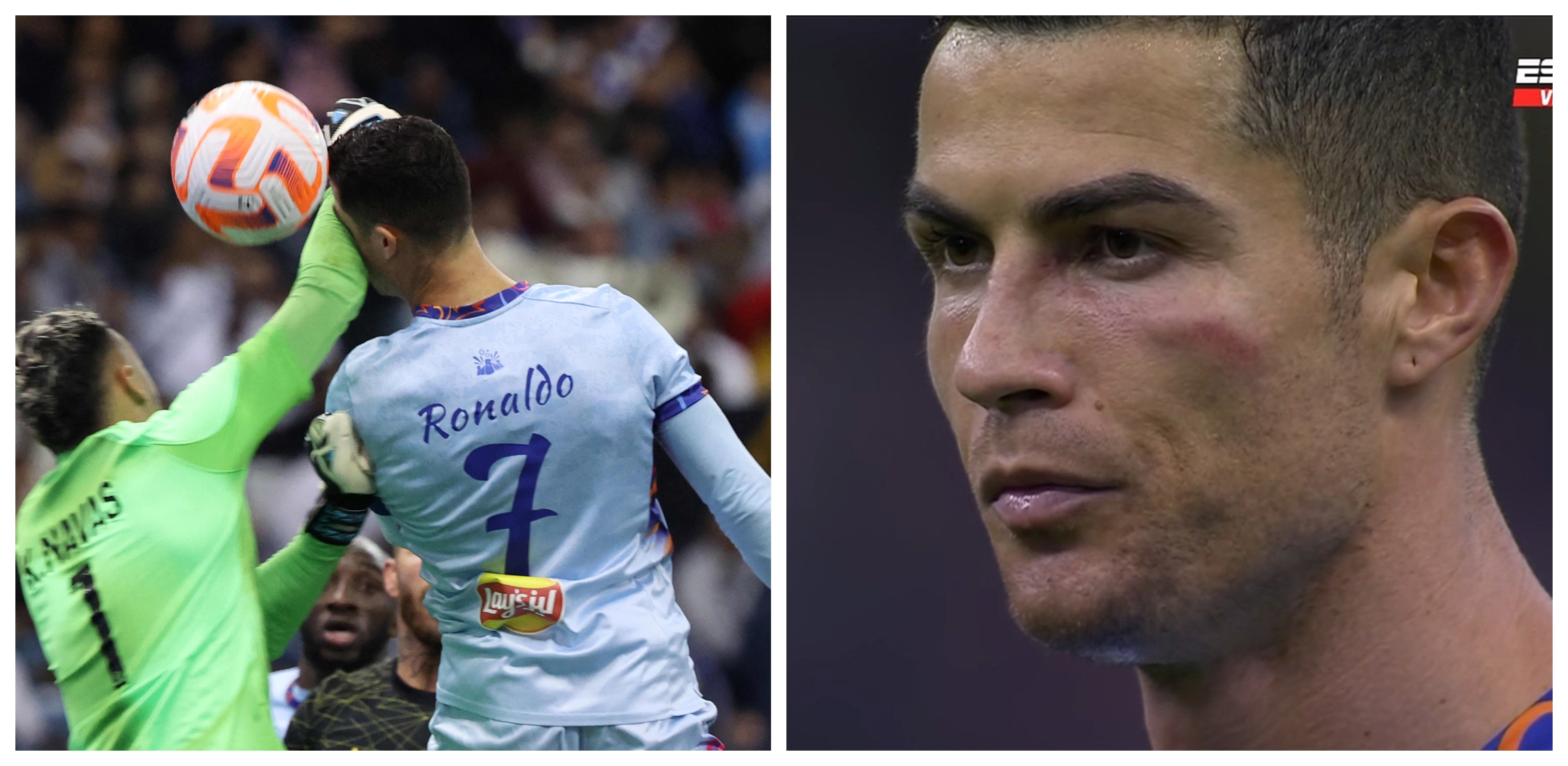 VIDEO As Fue El Brutal Golpe De Keylor Navas A Cristiano Ronaldo video-as-fue-el-brutal-golpe-de-keylor-navas-a-cristiano-ronaldo