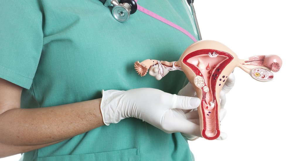 El leiomiosarcoma uterino es una forma rara de cáncer que afecta las células del músculo liso. Getty Images