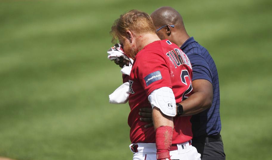 Turner estará fuera por un buen tiempo en lo que se recupera. (Foto Prensa Libre: MLB)