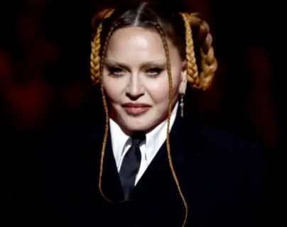 Madonna: fuente afirma que la cantante estaría desesperada por cambiar su aspecto físico y éstas serían las razones