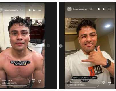 Léster Martínez deja ver las heridas en su rostro después de la pelea en Las Vegas