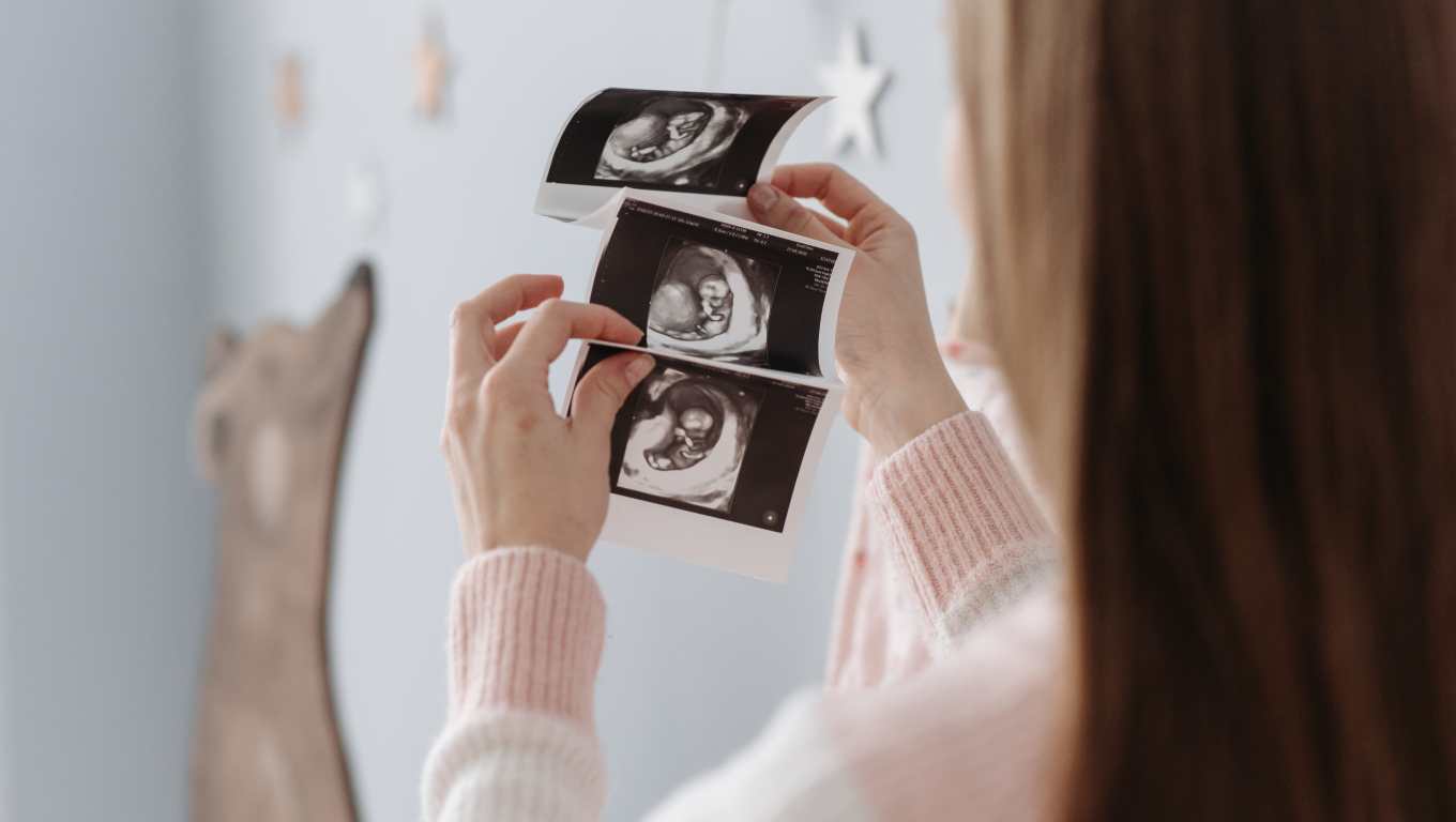 Foto ilustrativa de una mujer que observa los ultrasonidos de su embarazo. (Foto Prensa Libre: Pexels)