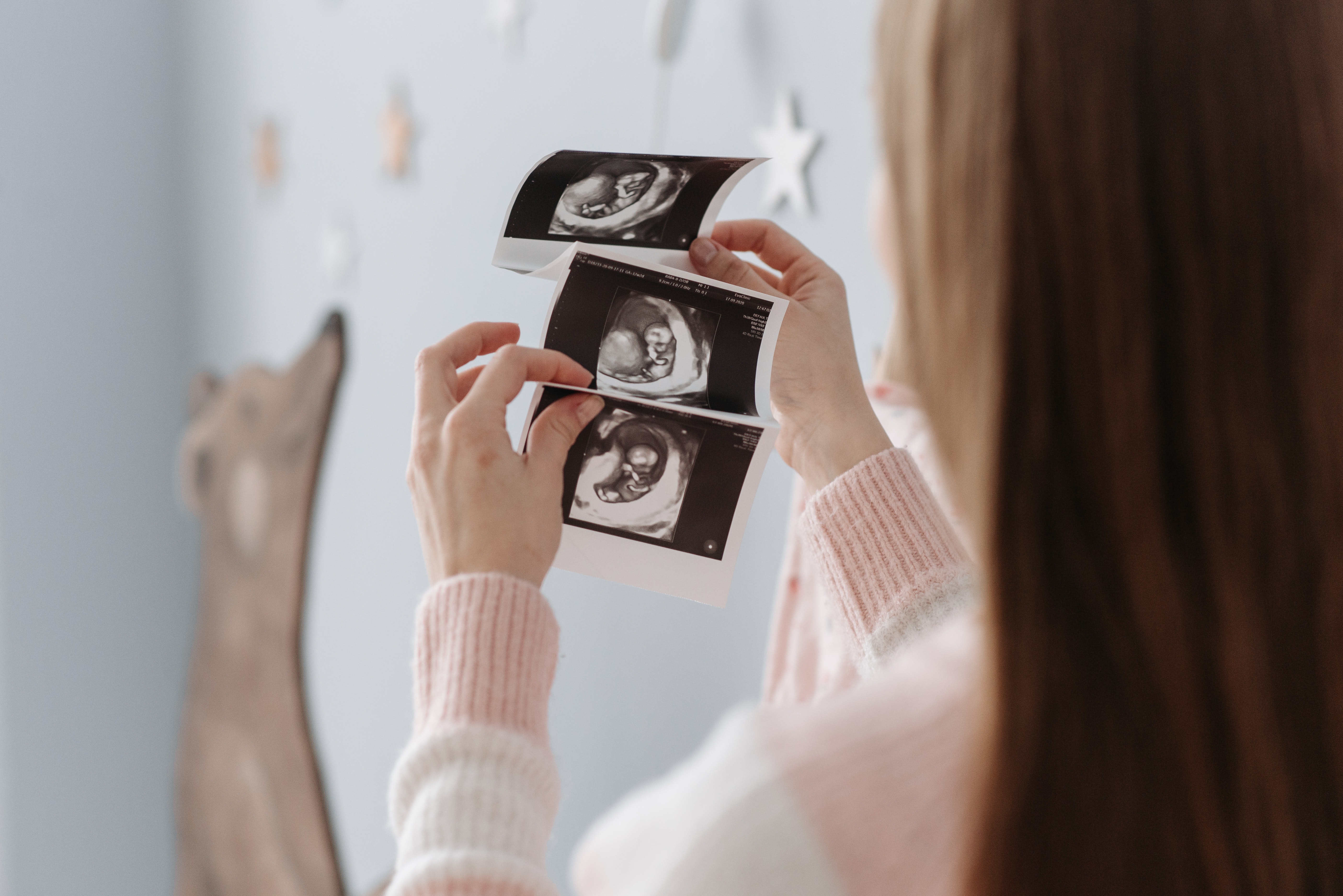Foto ilustrativa de una mujer que observa los ultrasonidos de su embarazo. (Foto Prensa Libre: Pexels)