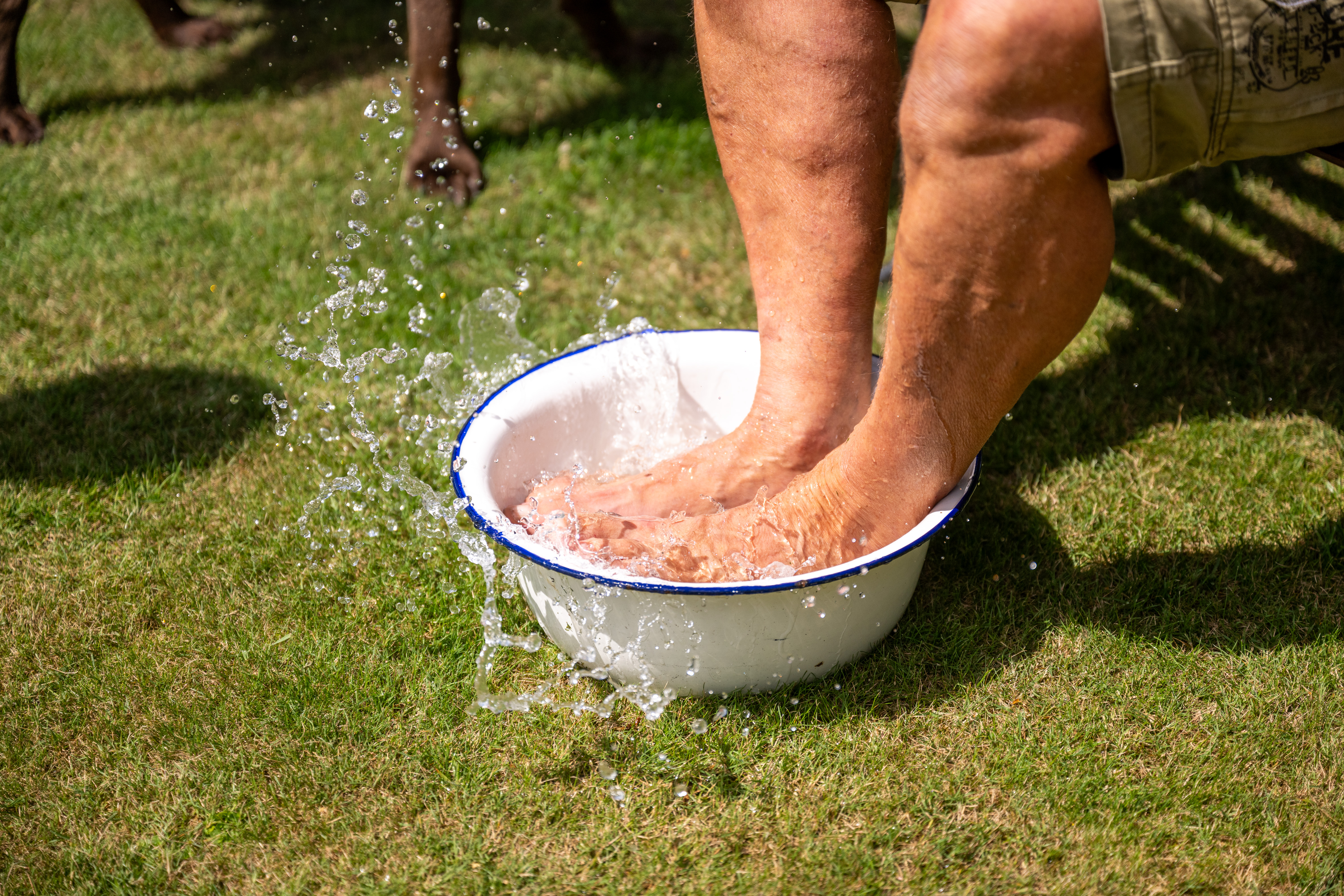 Siete consejos para alivianar las piernas hinchadas en días de calor
