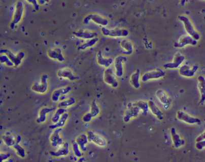 Síntomas de la ameba “come cerebro”, qué es y cómo infecta al cuerpo humano
