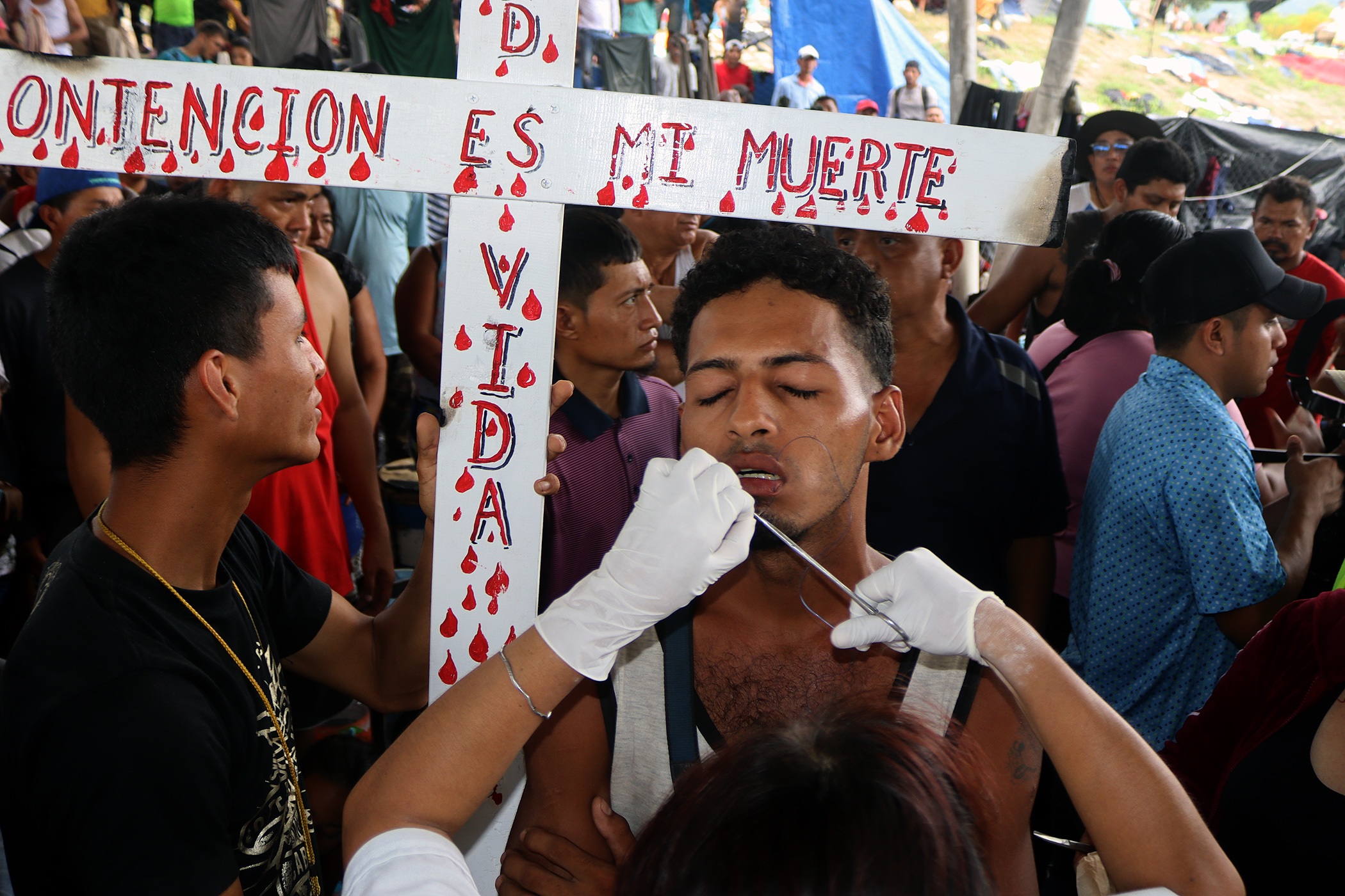 Un migrante se cose los labios como protesta para pedir permiso de paso en México hacia Estados Unidos. (Foto Prensa Libre: EFE/Juan Manuel Blanco)