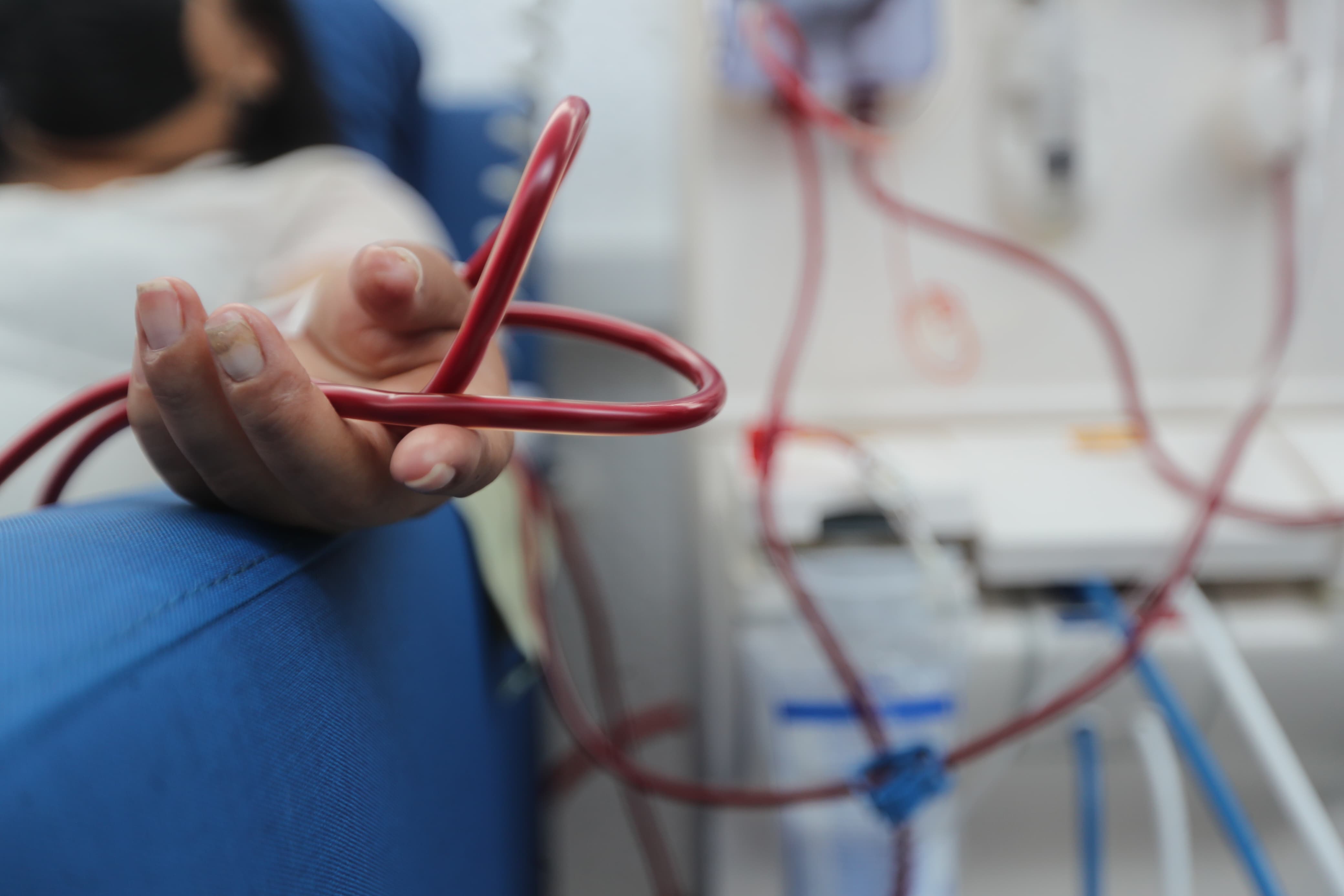 En Guatemala a cada 45 minutos se diagnostica un paciente renal