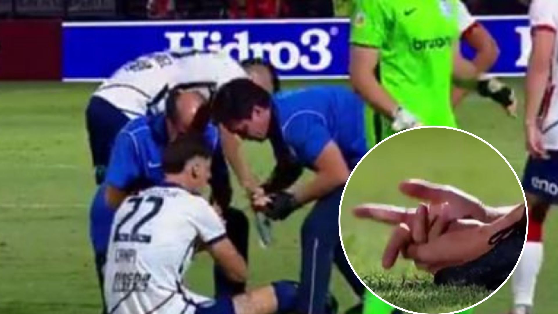 El jugador de Rosario Central, Gastón Campi, cuando sufrió la lesión en uno de sus dedos. (Foto Prensa Libre: RRSS)