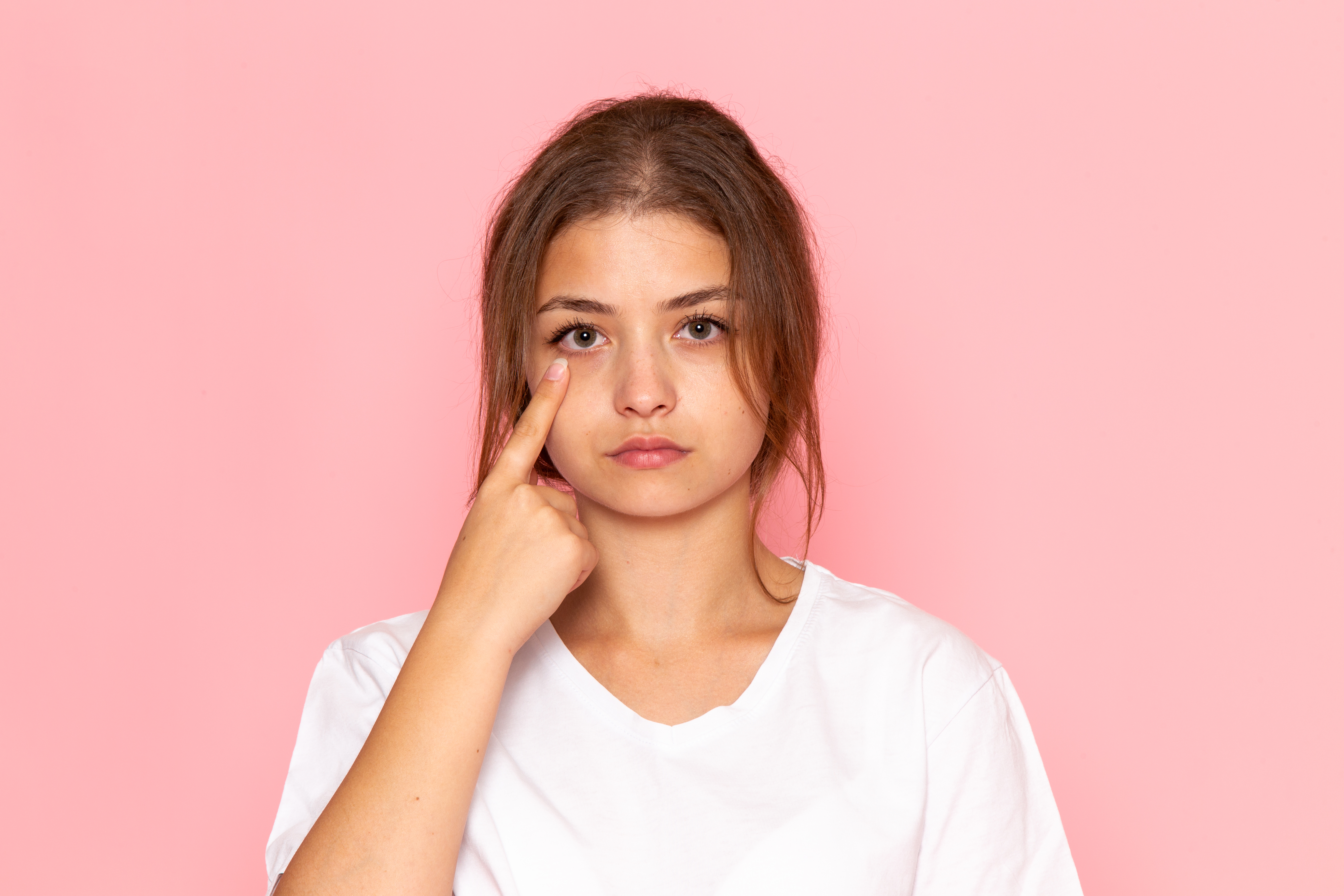 Ojeras: Qué son, cuáles son las causas y 10 consejos de dermatólogos para eliminarlas