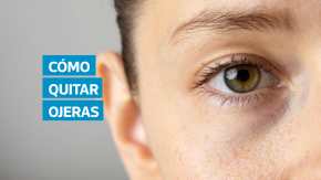 Las ojeras pueden dar un aspecto cansado, pero no siempre son por falta de sueño. Factores genéticos, deshidratación o problemas en la piel pueden influir. Conozca qué las provoca y qué recomiendan los dermatólogos para tratarlas de forma efectiva.