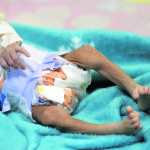 Este año han fallecido 51 niños menores de cinco años por desnutrición aguda, según reporte oficial. (Foto Prensa Libre: Hemeroteca PL)