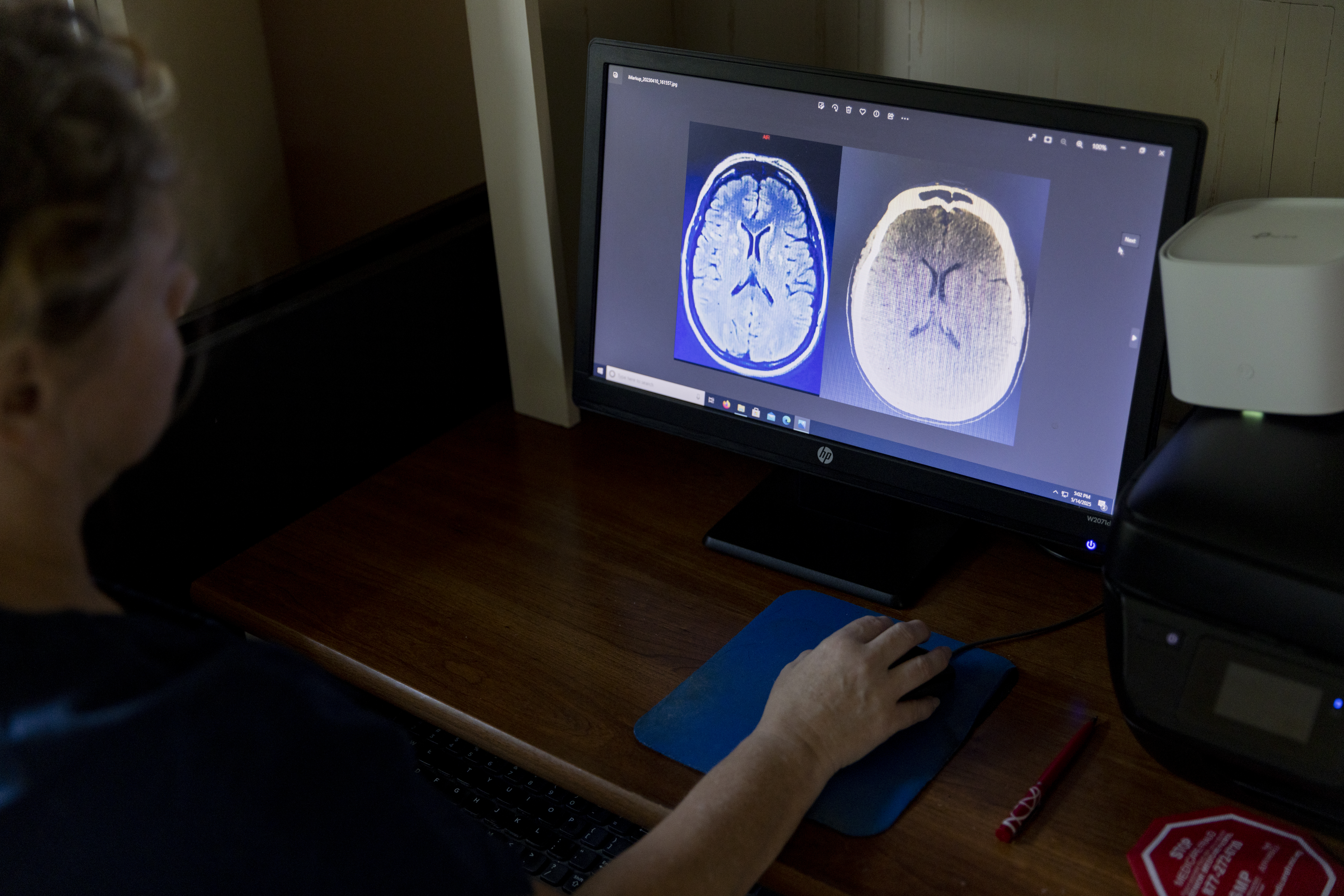 Heather Payne shares an MRI and CT scan after her strokes. MUST CREDIT: Kendrick Brinson/For The Washington Post