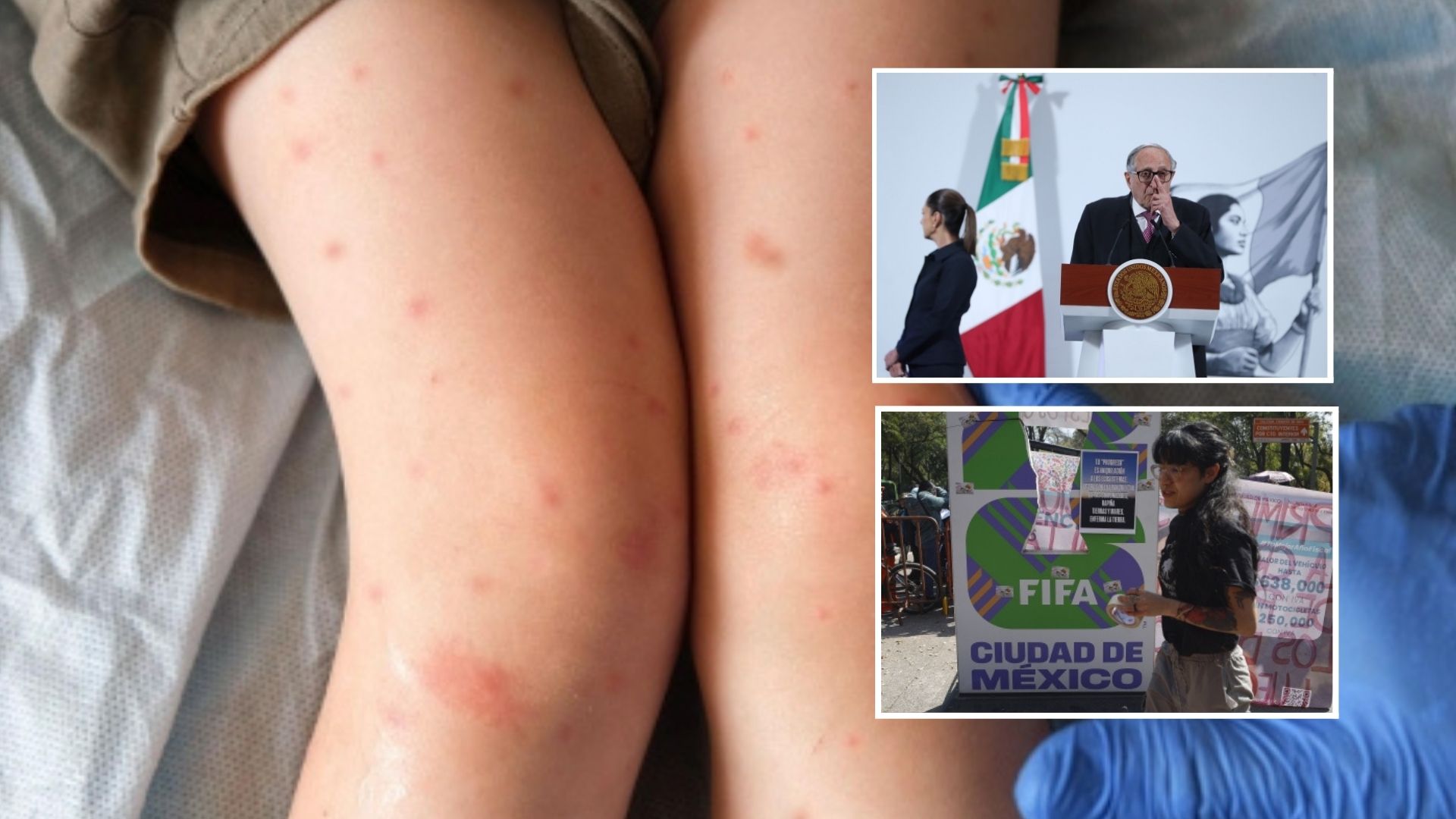 México encabeza los contagios de sarampión en América con más de 7 mil casos y 24 muertes, seguido por Canadá (5,436 casos) y Estados Unidos (2,242 contagios), según la OPS. (Foto, Prensa Libre: ShutterStock /EFE)