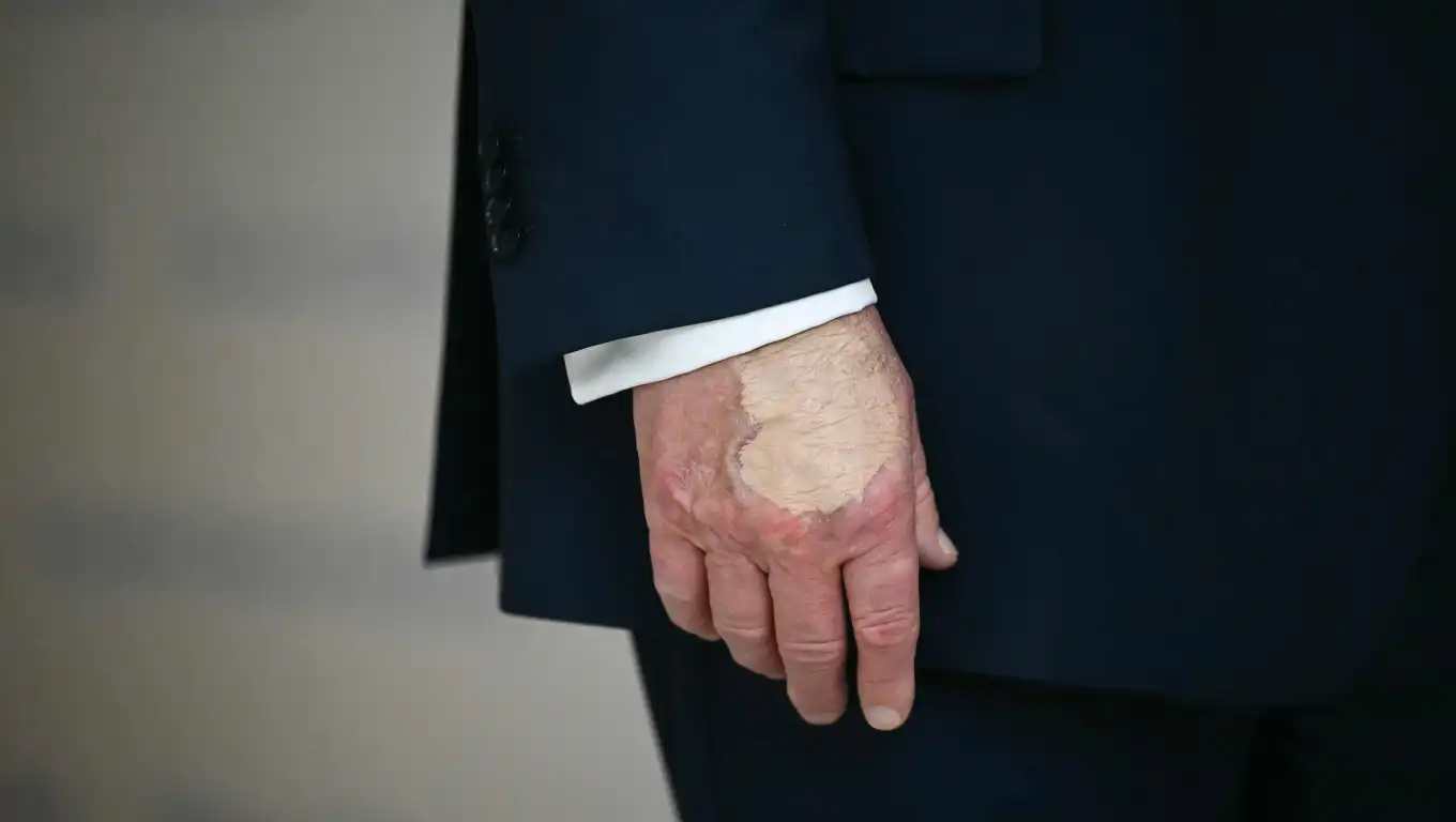 Se ve la mano del presidente estadounidense Donald Trump mientras habla en la Casa Blanca, frente a la Oficina Eisenhower. (Foto Prensa Libre: AFP)
