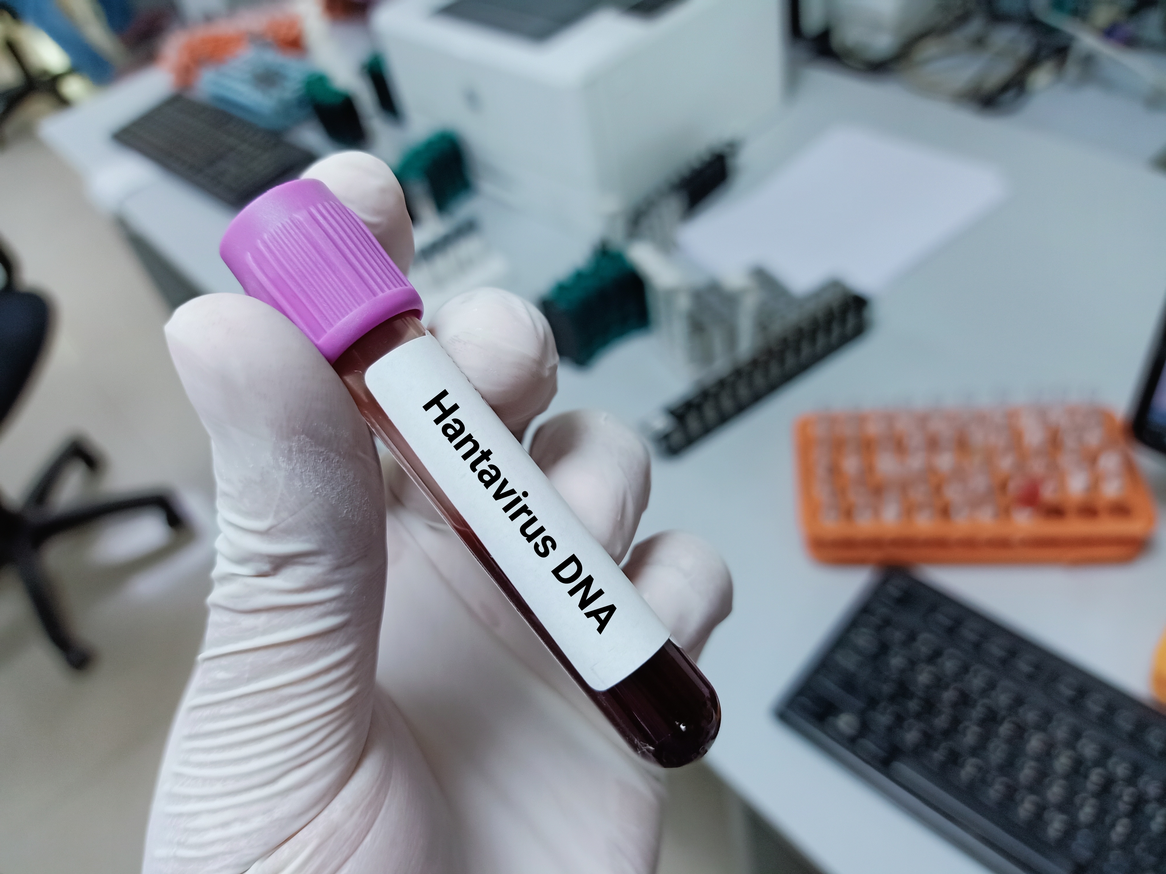 “Esto no es coronavirus”: OMS dice que no hay razones para que el brote de hantavirus se convierta en una gran epidemia