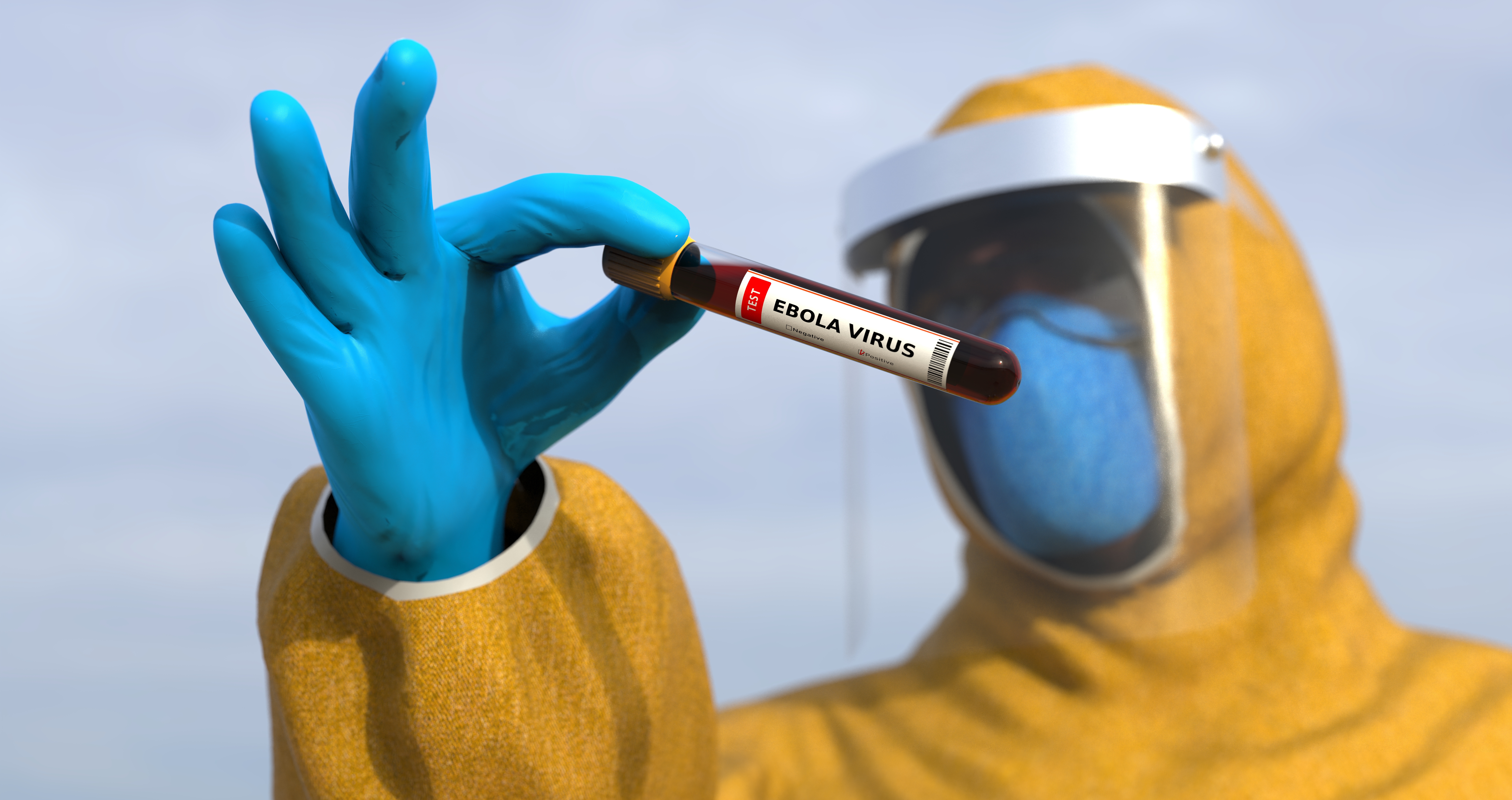 Francia activó los protocolos sanitarios tras confirmar un caso de ébola en un médico que regresó de RD del Congo. Cinco pasajeros permanecen aislados. (Foto Prensa Libre: Shutterstock)
