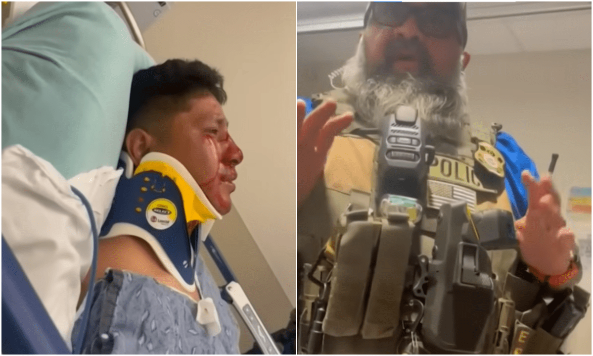 Guatemalteco es hospitalizado tras operativo del ICE: Termina con fractura nasal y dientes rotos