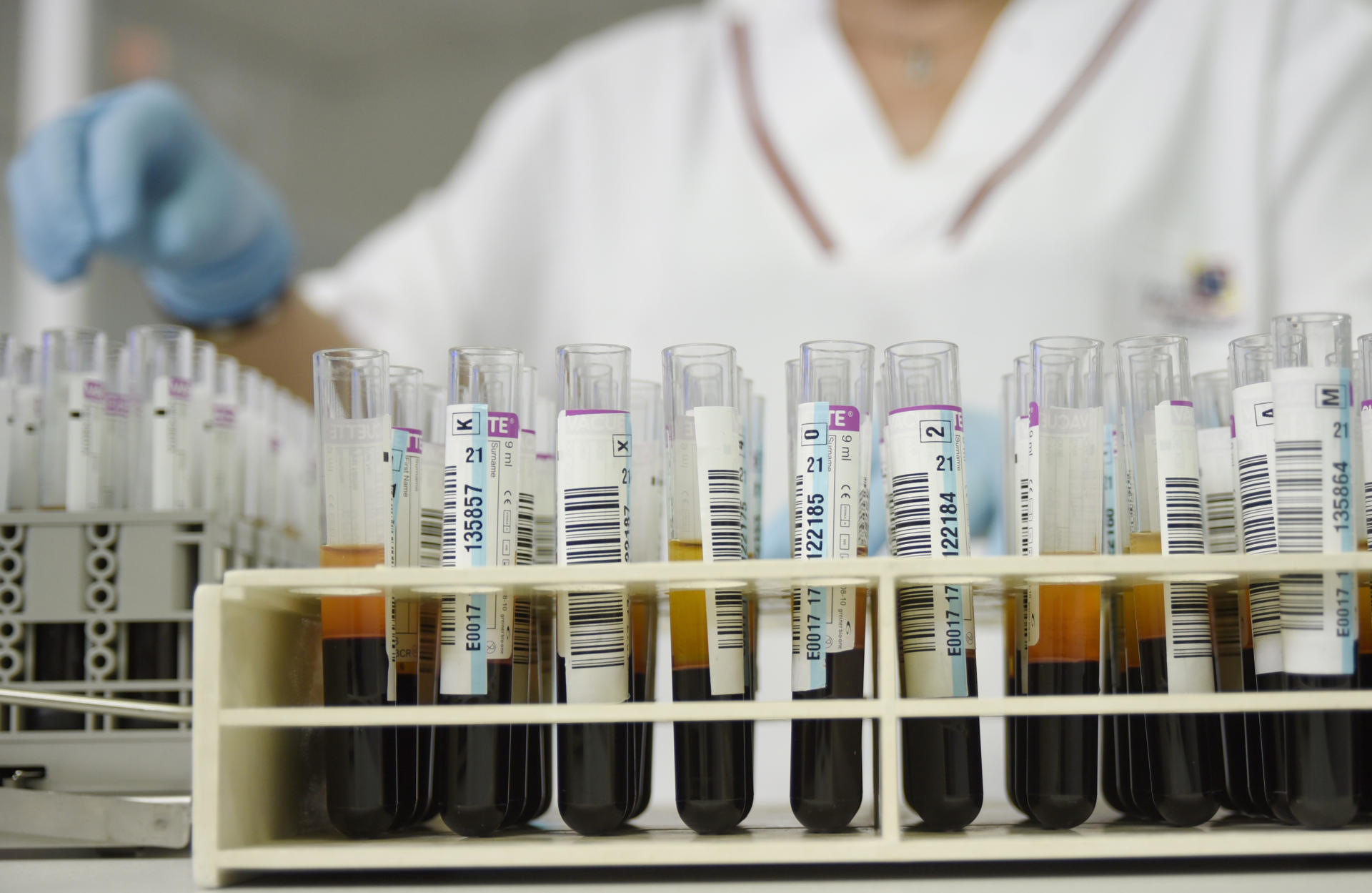 Tubos con extracciones de sangre en una imagen de archivo. EFE/Atienza.