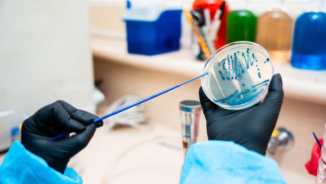 Las superbacterias representan una amenaza silenciosa en Guatemala, donde estudios científicos detectaron bacterias resistentes a los antibióticos dentro y fuera de los hospitales. (Foto Prensa Libre: UVG)